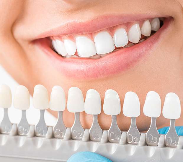 Paris Cosmetic Dentist