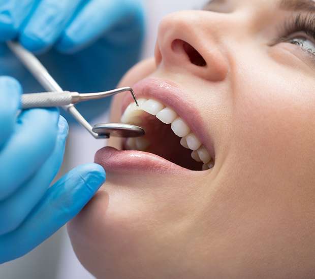 Paris Dental Bonding