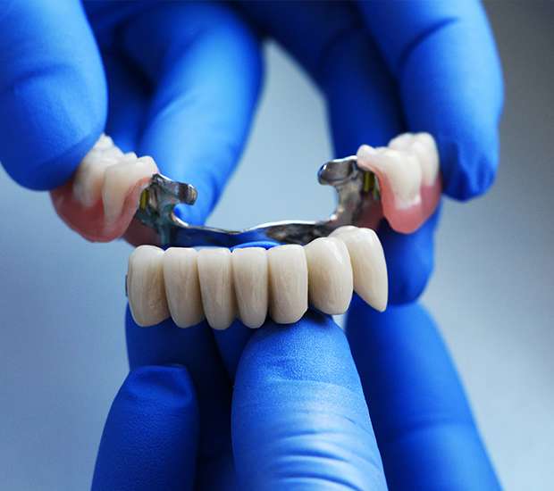 Paris Dental Bridges