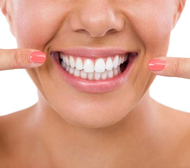 Paris What Is Gum Contouring and Reshaping