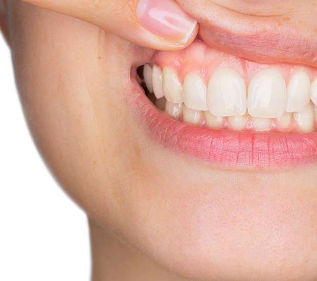 Paris Gum Disease