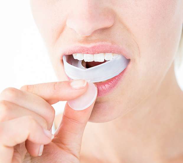 Paris Mouth Guards