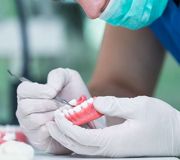 Paris Partial Dentures for Back Teeth