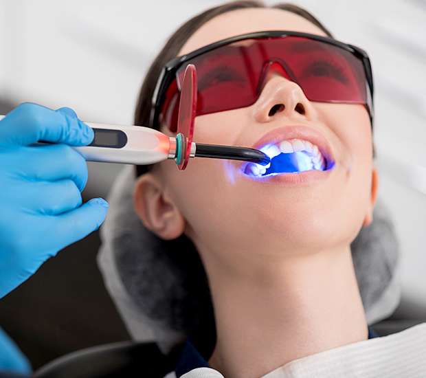 Paris Professional Teeth Whitening